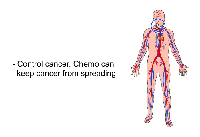 Control cancer. Chemo can keep cancer from spreading.