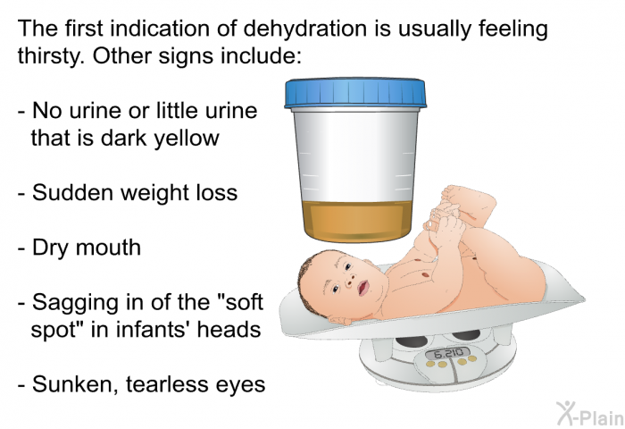 The first indication of dehydration is usually feeling thirsty. Other signs include:  No urine or little urine that is dark yellow Sudden weight loss Dry mouth Sagging in of the "soft spot" in infants' heads Sunken, tearless eyes
