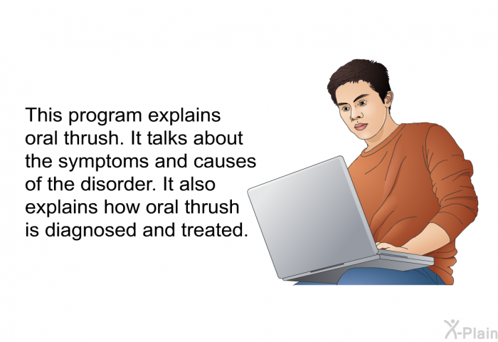 This health information explains oral thrush. It talks about the symptoms and causes of the disorder. It also explains how oral thrush is diagnosed and treated.