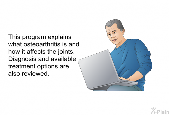 This health information explains what osteoarthritis is and how it affects the joints. Diagnosis and available treatment options are also reviewed.