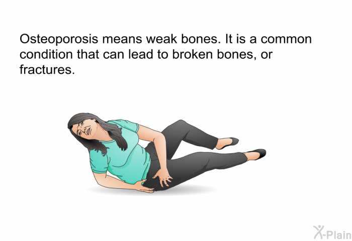 Osteoporosis means weak bones. It is a common condition that can lead to broken bones, or fractures.