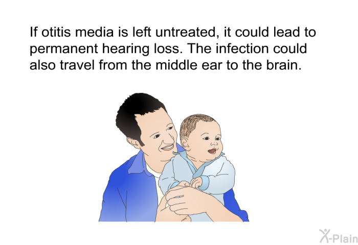 If otitis media is left untreated, it could lead to permanent hearing loss. The infection could also travel from the middle ear to the brain.