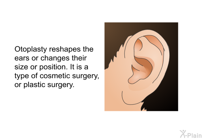 Otoplasty reshapes the ears or changes their size or position. It is a type of cosmetic surgery, or plastic surgery.