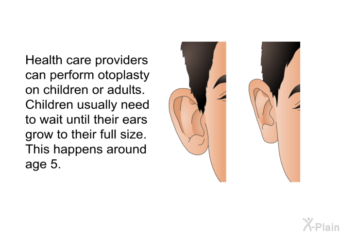 Health care providers can perform otoplasty on children or adults. Children usually need to wait until their ears grow to their full size. This happens around age 5.