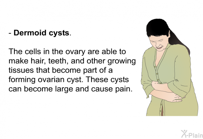 Dermoid cysts. The cells in the ovary are able to make hair, teeth, and other growing tissues that become part of a forming ovarian cyst. These cysts can become large and cause pain.