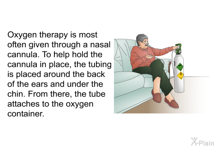 Oxygen therapy is most often given through a nasal cannula. To help hold the cannula in place, the tubing is placed around the back of the ears and under the chin. From there, the tube attaches to the oxygen container.