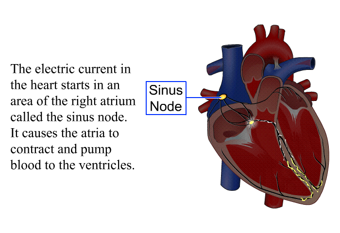The electric current in the heart starts in an area of the right atrium called the sinus node. It causes the atria to contract and pump blood to the ventricles.