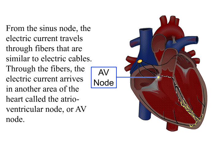 From the sinus node, the electric current travels through fibers that are similar to electric cables. Through the fibers, the electric current arrives in another area of the heart called the atrio-ventricular node, or AV node.