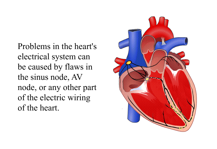 Problems in the heart's electrical system can be caused by flaws in the sinus node, AV node, or any other part of the electric wiring of the heart.