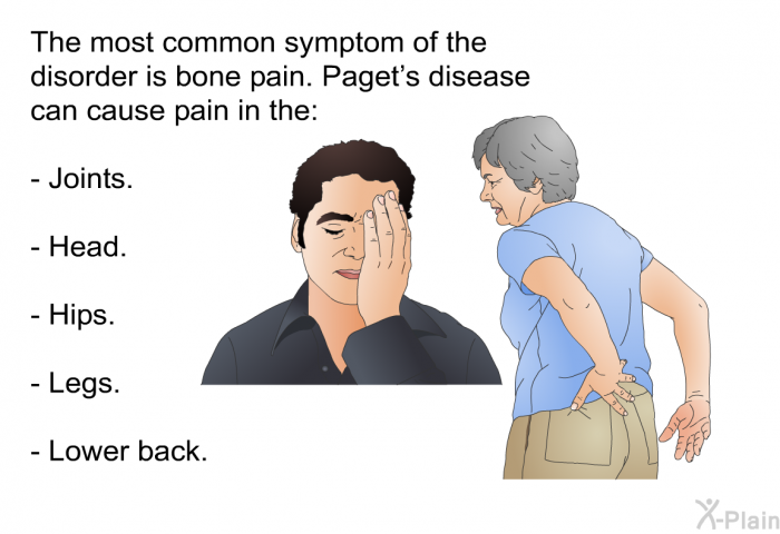 The most common symptom of the disorder is bone pain. Paget's disease can cause pain in the:  Joints. Head. Hips. Legs. Lower back.