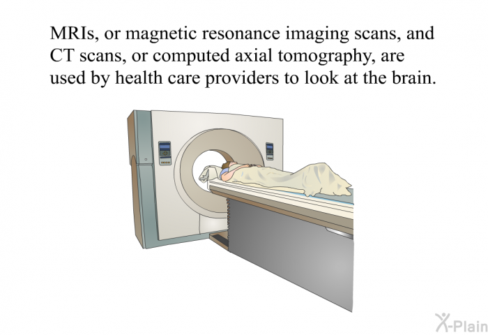 MRIs, or magnetic resonance imaging scans, and CT scans, or computed axial tomography, are used by health care providers to look at the brain.
