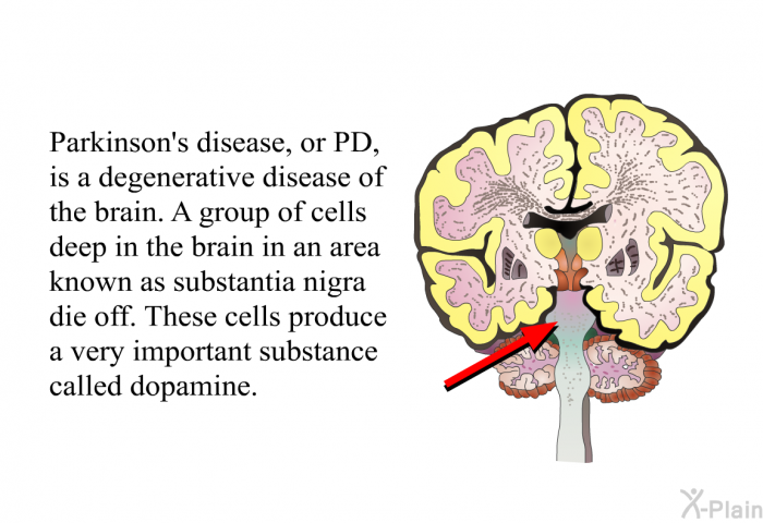 Parkinson's disease, or PD, is a degenerative disease of the brain. A group of cells deep in the brain in an area known as substantia nigra die off. These cells produce a very important substance called dopamine.