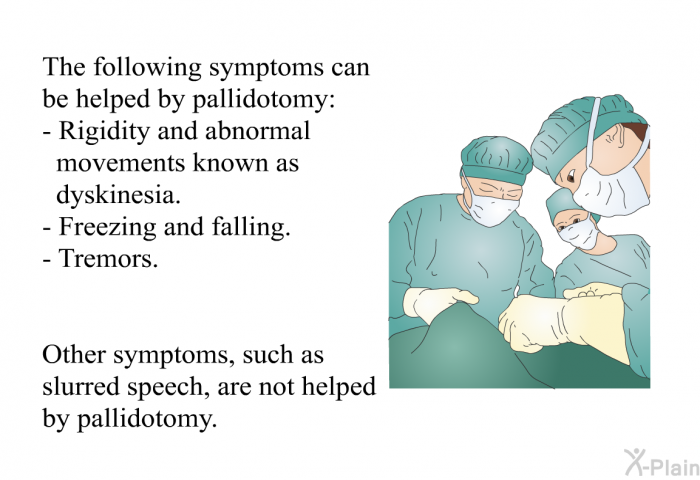 The following symptoms can be helped by pallidotomy:  Rigidity and abnormal movements known as dyskinesia. Freezing and falling. Tremors.  
 Other symptoms, such as slurred speech, are not helped by pallidotomy.