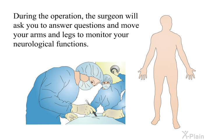 During the operation, the surgeon will ask you to answer questions and move your arms and legs to monitor your neurological functions.