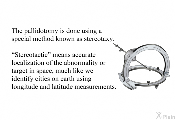 The pallidotomy is done using a special method known as stereotaxy. &ldquo;Stereotactic&rdquo; means accurate localization of the abnormality or target in space, much like we identify cities on earth using longitude and latitude measurements.