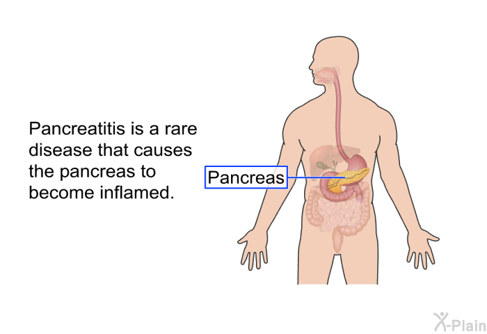 Pancreatitis is a rare disease that causes the pancreas to become inflamed.