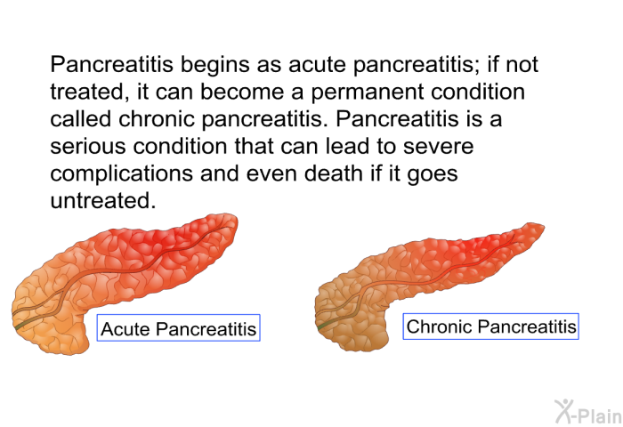 Pancreatitis begins as acute pancreatitis; if not treated, it can become a permanent condition called chronic pancreatitis. Pancreatitis is a serious condition that can lead to severe complications and even death if it goes untreated.