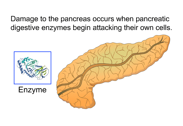 Damage to the pancreas occurs when pancreatic digestive enzymes begin attacking their own cells.