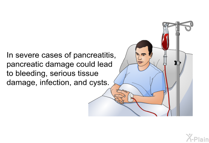In severe cases of pancreatitis, pancreatic damage could lead to bleeding, serious tissue damage, infection, and cysts.