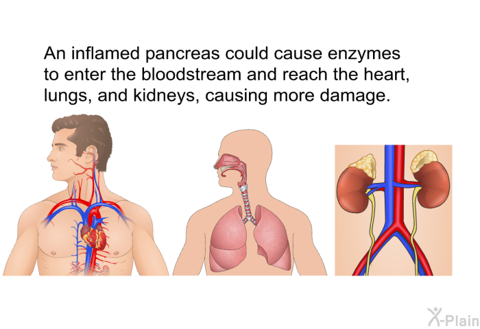 An inflamed pancreas could cause enzymes to enter the bloodstream and reach the heart, lungs, and kidneys, causing more damage.