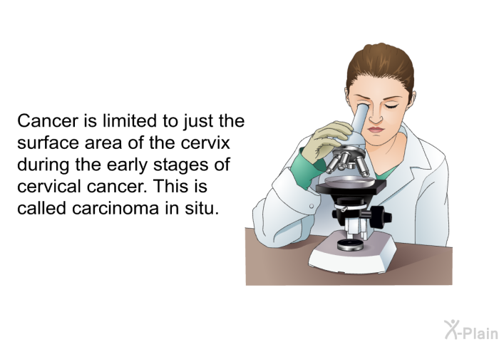 Cancer is limited to just the surface area of the cervix during the early stages of cervical cancer. This is called carcinoma in situ.