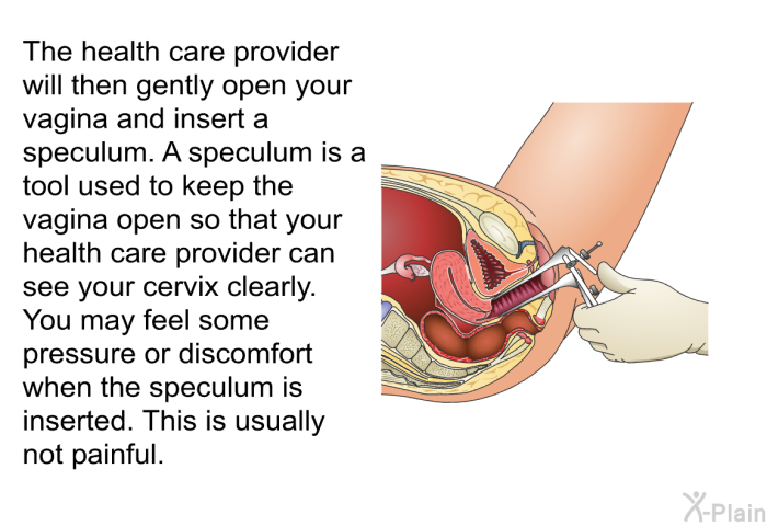 The health care provider will then gently open your vagina and insert a speculum. A speculum is a tool used to keep the vagina open so that your health care provider can see your cervix clearly. You may feel some pressure or discomfort when the speculum is inserted. This is usually not painful.