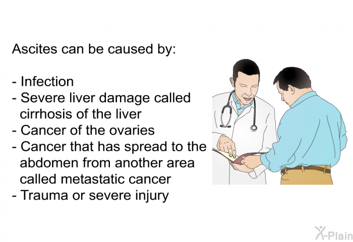 Ascites can be caused by:  Infection Severe liver damage called Cirrhosis of the liver Cancer of the ovaries Cancer that has spread to the abdomen from another area called metastatic cancer Trauma or severe injury