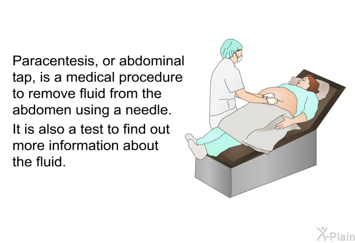 Paracentesis, or abdominal tap, is a medical procedure to remove fluid from the abdomen using a needle. It is also a test to find out more information about the fluid.