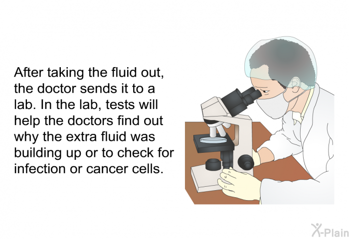 After taking the fluid out, the doctor sends it to a lab. In the lab, tests will help the doctors find out why the extra fluid was building up or to check for infection or cancer cells.