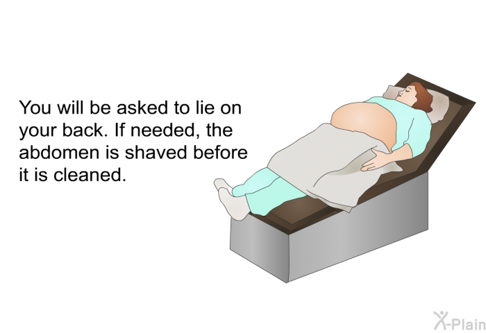 You will be asked to lie on your back. If needed, the abdomen is shaved before it is cleaned.