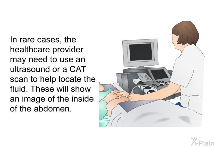 In rare cases, the healthcare provider may need to use an ultrasound or a CAT scan to help locate the fluid. These will show an image of the inside of the abdomen.