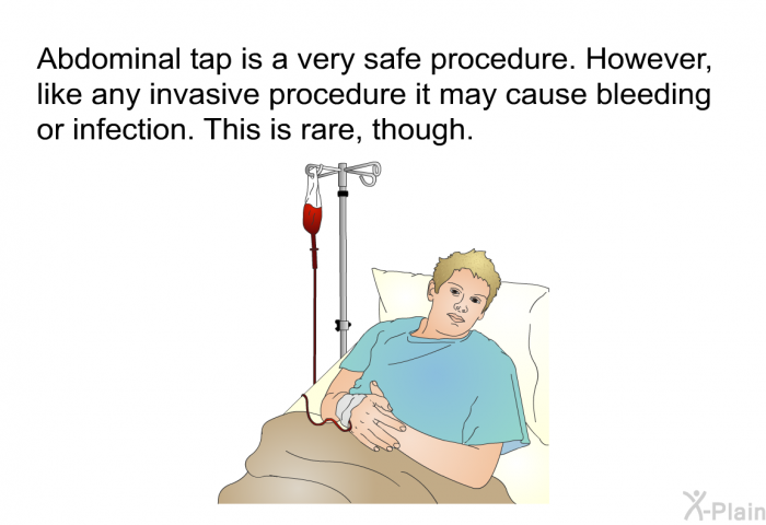 Abdominal tap is a very safe procedure. However, like any invasive procedure it may cause bleeding or infection. This is rare, though.