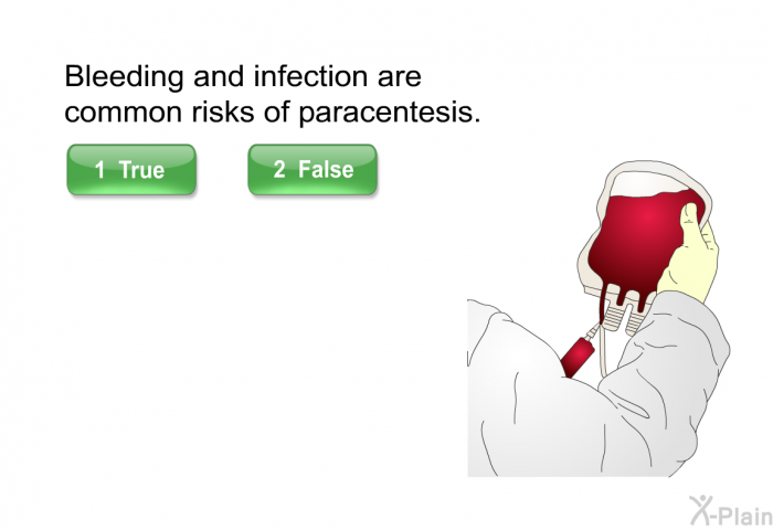 Bleeding and infection are common risks of paracentesis. Press true or false