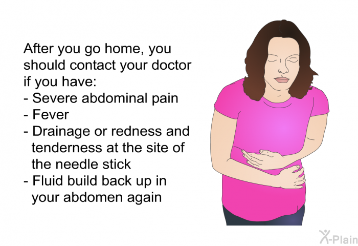 After you go home, you should contact your doctor if you have:  Severe abdominal pain Fever Drainage or redness and tenderness at the site of the needle stick Fluid build back up in your abdomen again