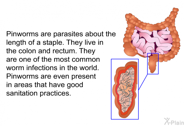 Pinworms are parasites about the length of a staple. They live in the colon and rectum. They are one of the most common worm infections in the world. Pinworms are even present in areas that have good sanitation practices.