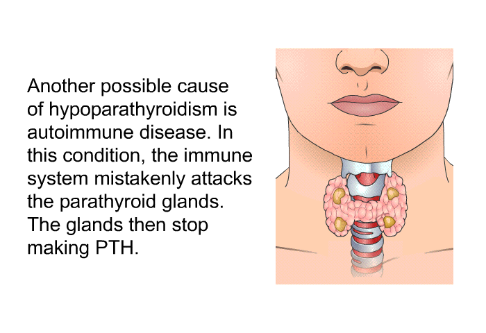 Another possible cause of hypoparathyroidism is autoimmune disease. In this condition, the immune system mistakenly attacks the parathyroid glands. The glands then stop making PTH.