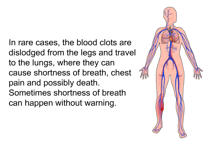 In rare cases, the blood clots are dislodged from the legs and travel to the lungs, where they can cause shortness of breath, chest pain and possibly death. Sometimes shortness of breath can happen without warning.