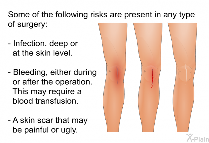Some of the following risks are present in any type of surgery:  Infection, deep or at the skin level. Bleeding, either during or after the operation. This may require a blood transfusion. A skin scar that may be painful or ugly.