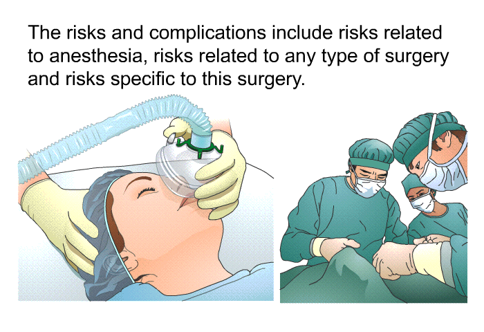 The risks and complications include risks related to anesthesia, risks related to any type of surgery and risks specific to this surgery.