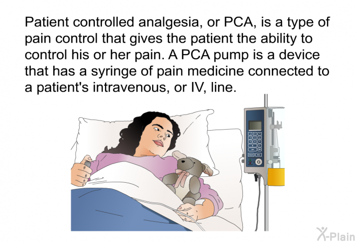Patient controlled analgesia, or PCA, is a type of pain control that gives the patient the ability to control his or her pain. A PCA pump is a device that has a syringe of pain medicine connected to a patient's intravenous, or IV, line.