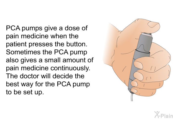 PCA pumps give a dose of pain medicine when the patient presses the button. Sometimes the PCA pump also gives a small amount of pain medicine continuously. The doctor will decide the best way for the PCA pump to be set up.