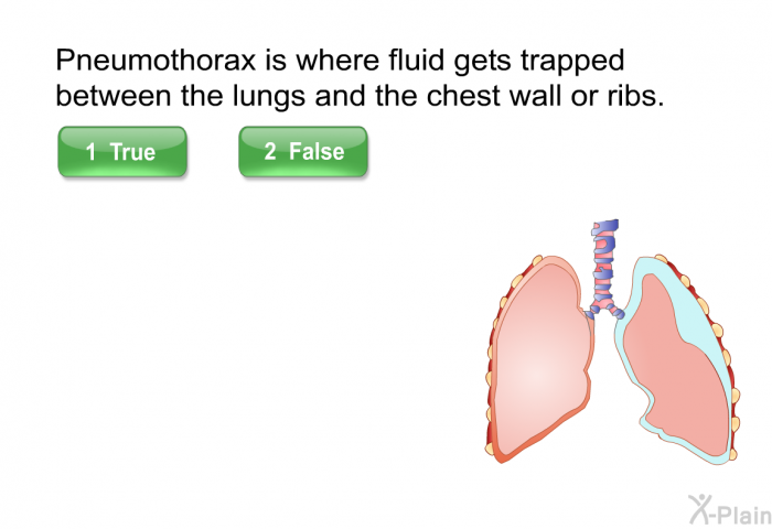 Pneumothorax is where fluid gets trapped between the lungs and the chest wall or ribs. Press True or False