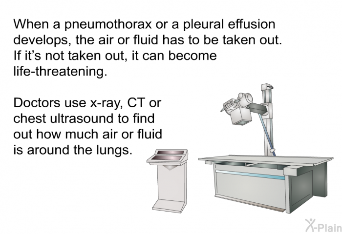 When a pneumothorax or a pleural effusion develops, the air or fluid has to be taken out. If it’s not taken out, it can become life-threatening. Doctors use x-ray, CT or chest ultrasound to find out how much air or fluid is around the lungs.