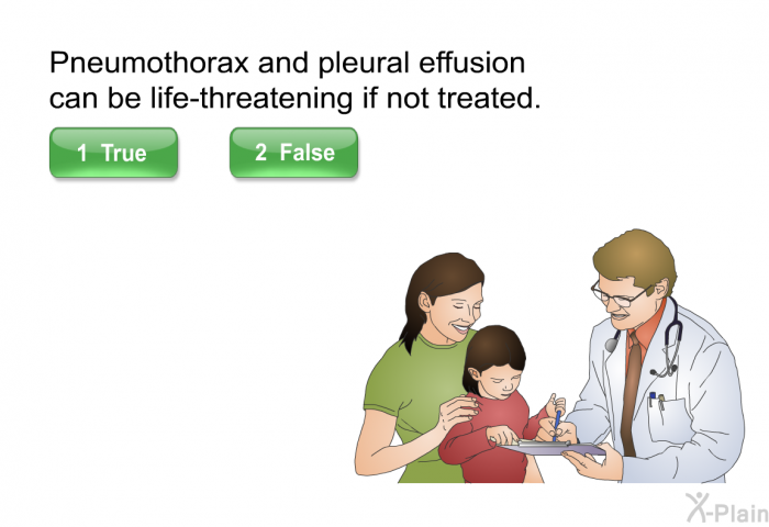 Pneumothorax and pleural effusion can be life-threatening if not treated. Press True or False