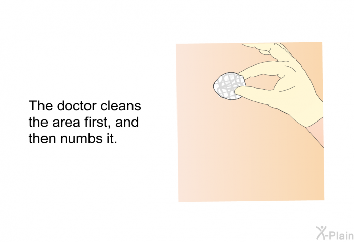 The doctor cleans the area first, and then numbs it.