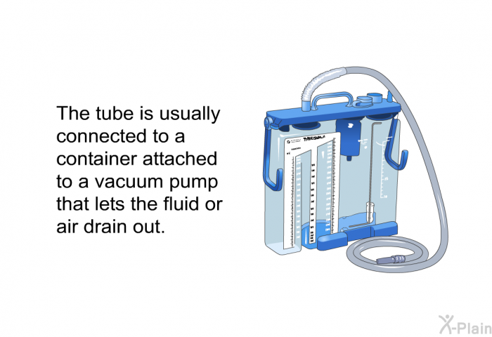 The tube is usually connected to a container attached to a vacuum pump that lets the fluid or air drain out.