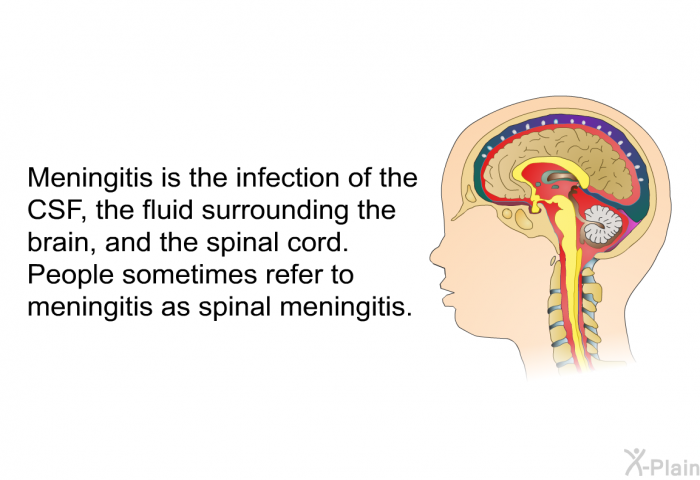 Meningitis is the infection of the CSF, the fluid surrounding the brain, and the spinal cord. People sometimes refer to meningitis as spinal meningitis.