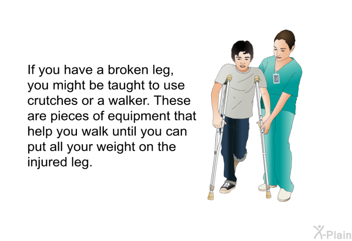 If you have a broken leg, you might be taught to use crutches or a walker. These are pieces of equipment that help you walk until you can put all your weight on the injured leg.
