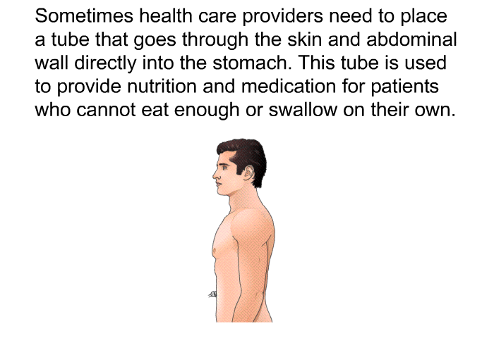 Sometimes health care providers need to place a tube that goes through the skin and abdominal wall directly into the stomach. This tube is used to provide nutrition and medications for patients who cannot eat enough or swallow on their own.