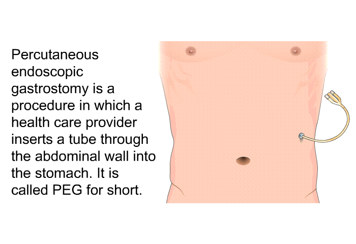 Percutaneous endoscopic gastrostomy is a procedure in which a health care provider inserts a tube through the abdominal wall into the stomach. It is called PEG for short.